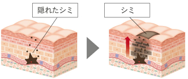 できる前にシミ対策